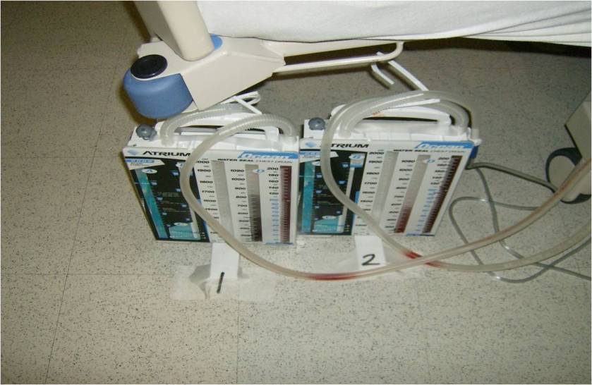 Ideally chest tubes would be well marked and not taped to floor, but the realiy often differs (from 